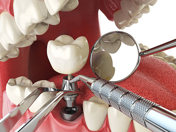 Best Emergency Treatment for Oral Infections in Woodlake, CA